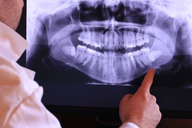 Trusted MD Emergency Dental Service Experts