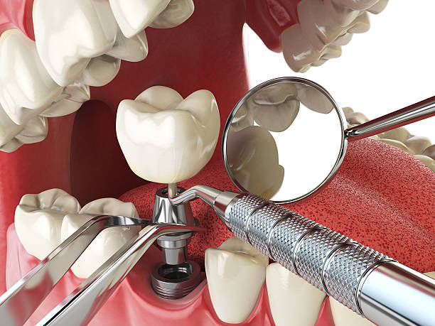 Best 24-Hour Emergency Dental Care in Perryman, MD